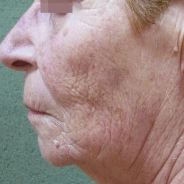 Before