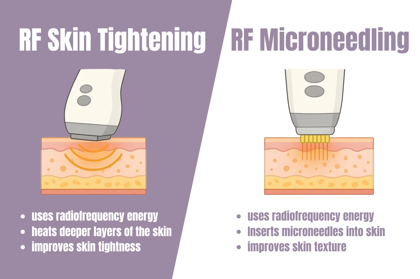 Skin Tightening vs. RF Microneedling - Barris Laser & Skin Care ...
